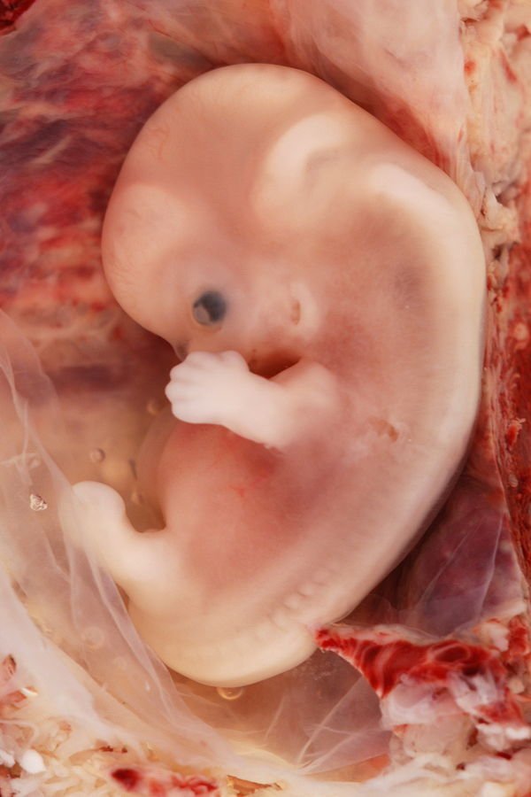 Sviluppo del embrione durante il primo trimestre 