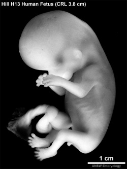 Il feto alla nona settimana