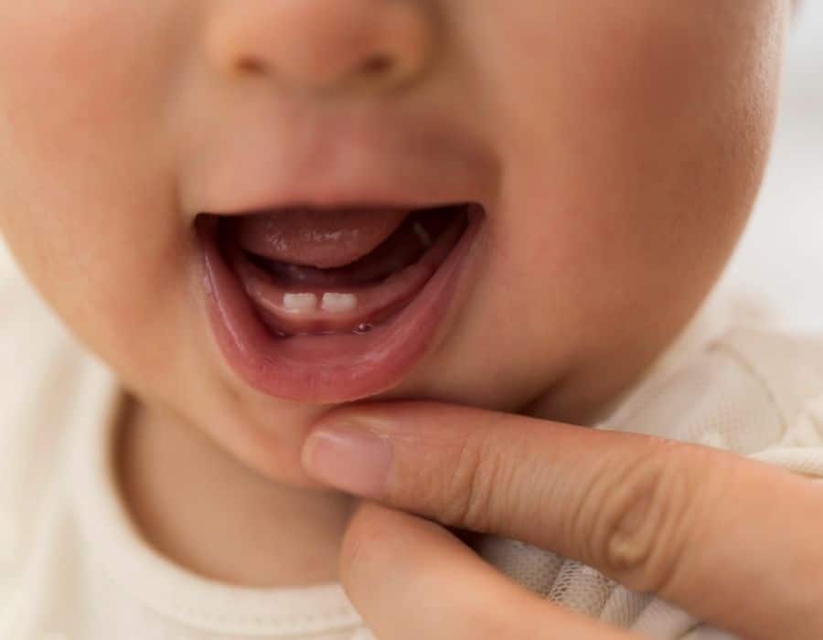 Dentini neonato