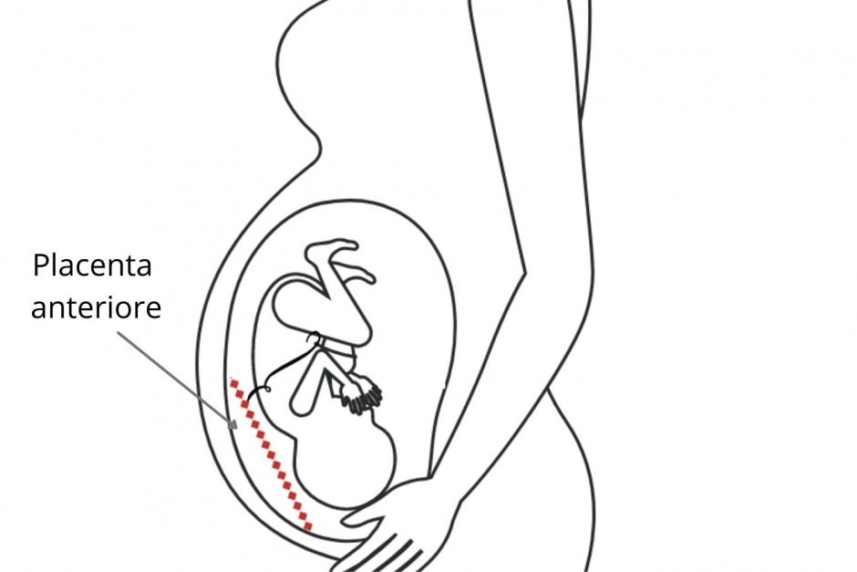 placenta anteriore
