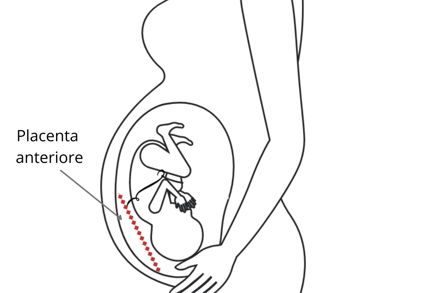 Placenta anteriore: caratteristiche e possibili complicazioni