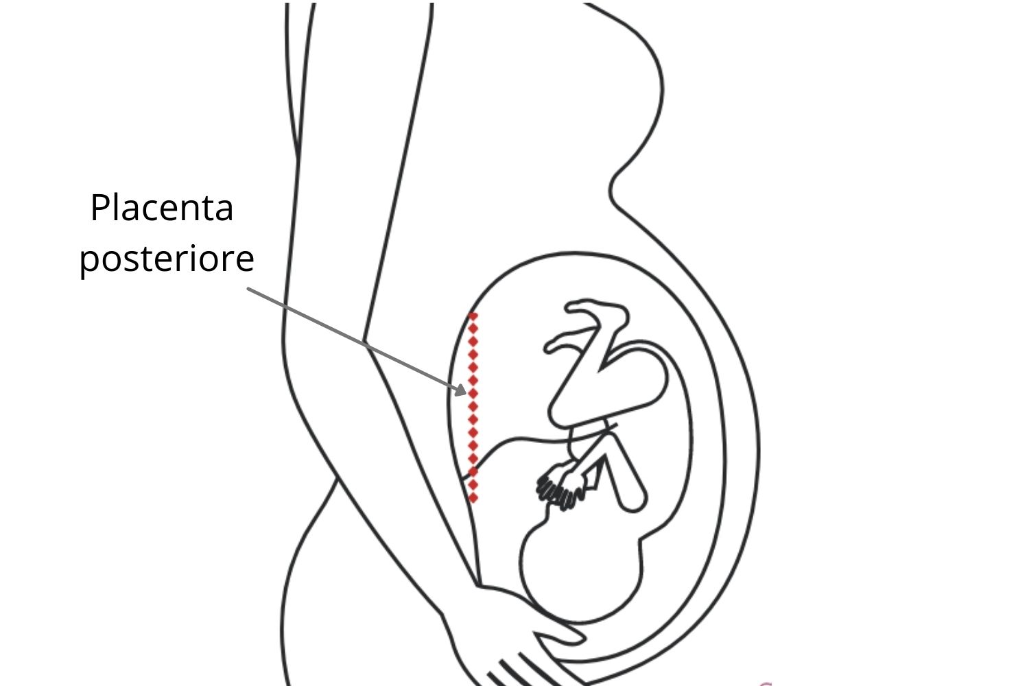 Placenta posteriore